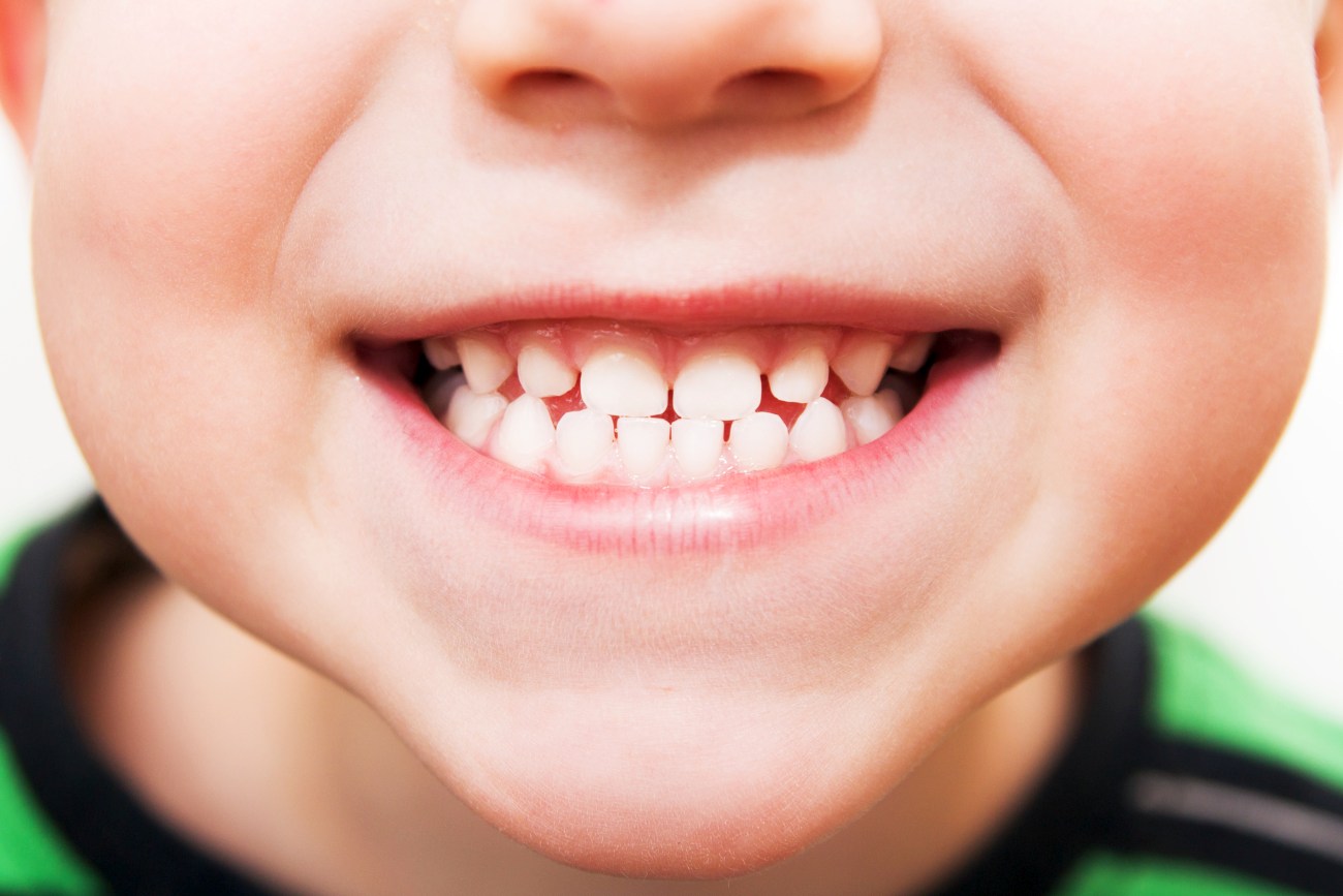 Jakie minerały wzmocnią dziecięce zęby